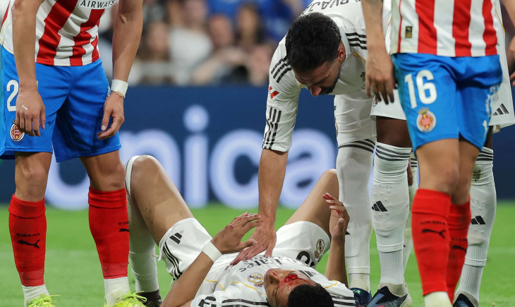 "Blind Spot": Referee Shocks with No Penalty Call for Mbappé vs. Girona | Goal.com
